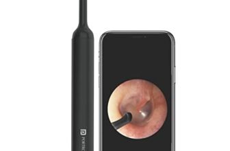 Portronics Xlife Smart Wireless Ear Otoscope Cleaner with 6 LED Lights, FHD 1080 Camera, 3 Mega pixels Endoscope, Control Via App(Black)